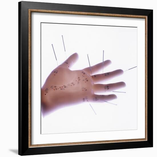 Acupuncture Model-Cristina-Framed Premium Photographic Print