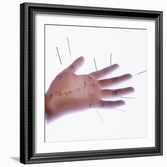 Acupuncture Model-Cristina-Framed Premium Photographic Print