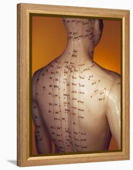 Acupuncture Model-Lawrence Lawry-Framed Premier Image Canvas