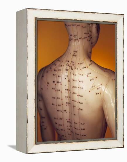 Acupuncture Model-Lawrence Lawry-Framed Premier Image Canvas