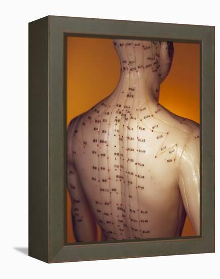 Acupuncture Model-Lawrence Lawry-Framed Premier Image Canvas