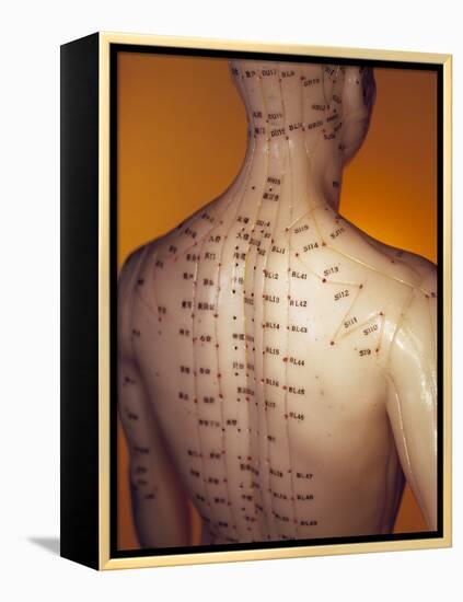 Acupuncture Model-Lawrence Lawry-Framed Premier Image Canvas