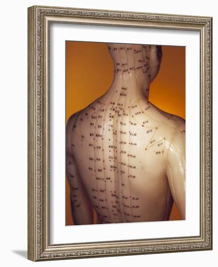 Acupuncture Model-Lawrence Lawry-Framed Photographic Print