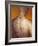 Acupuncture Model-Lawrence Lawry-Framed Photographic Print