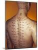 Acupuncture Model-Lawrence Lawry-Mounted Photographic Print
