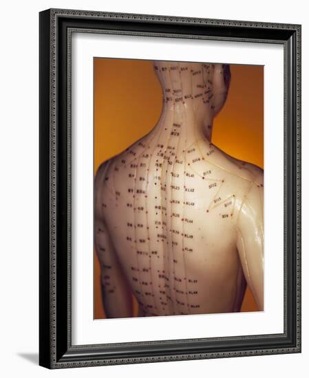 Acupuncture Model-Lawrence Lawry-Framed Photographic Print