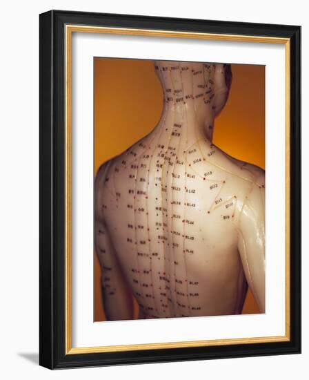 Acupuncture Model-Lawrence Lawry-Framed Photographic Print