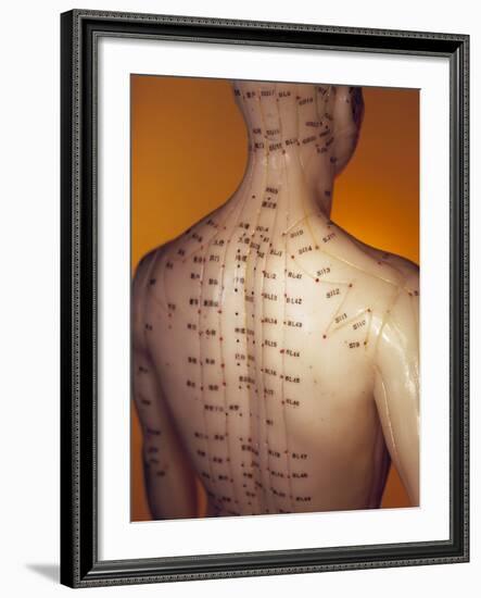 Acupuncture Model-Lawrence Lawry-Framed Photographic Print