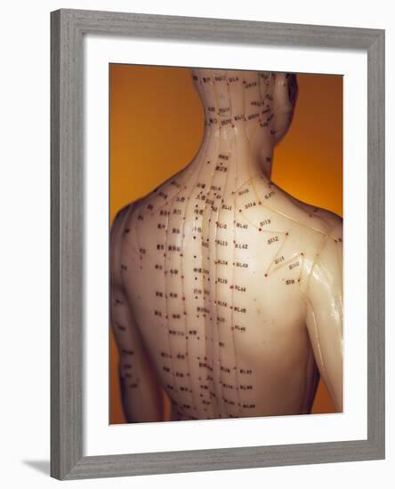 Acupuncture Model-Lawrence Lawry-Framed Photographic Print