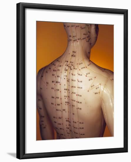 Acupuncture Model-Lawrence Lawry-Framed Photographic Print