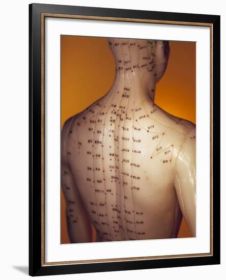 Acupuncture Model-Lawrence Lawry-Framed Photographic Print