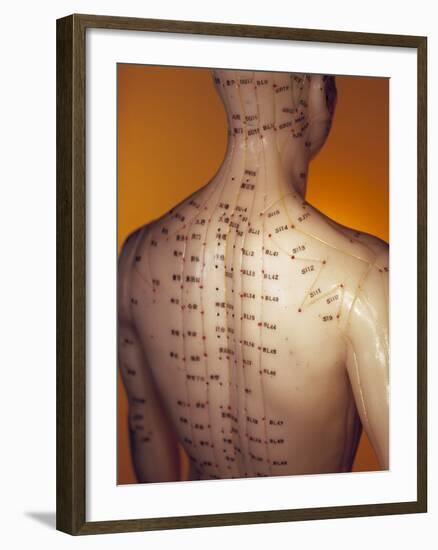 Acupuncture Model-Lawrence Lawry-Framed Photographic Print