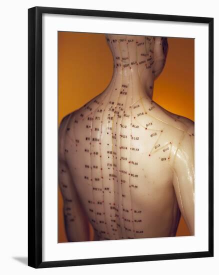 Acupuncture Model-Lawrence Lawry-Framed Photographic Print