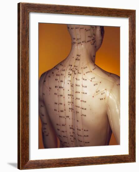 Acupuncture Model-Lawrence Lawry-Framed Photographic Print