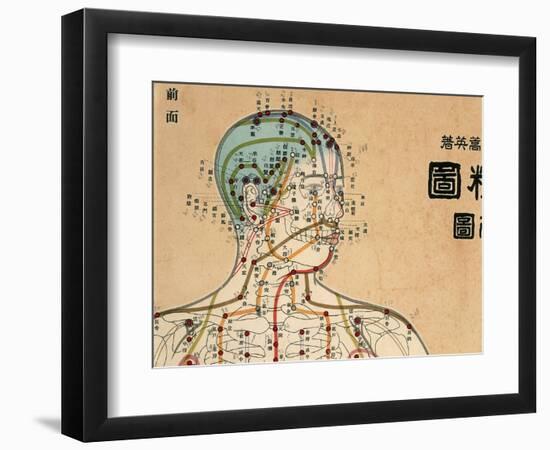 Acupuncture Points and Meridians of Human Body-null-Framed Giclee Print