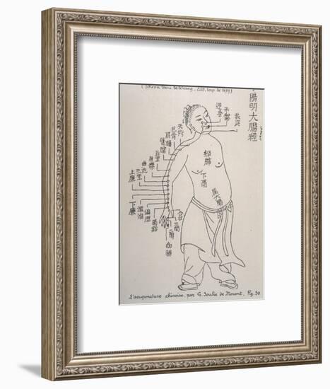Acupuncture the Meridian of the Large Intestine-null-Framed Art Print