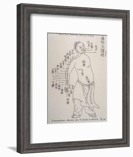 Acupuncture the Meridian of the Large Intestine-null-Framed Art Print