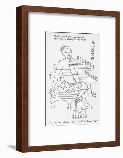 Acupuncture the Meridian of the Loins-Tchenn Tsiou Ta-tcheng-Framed Photographic Print