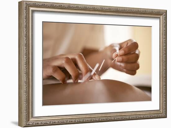 Acupuncture-Adam Gault-Framed Premium Photographic Print