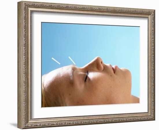 Acupuncture-Mauro Fermariello-Framed Photographic Print