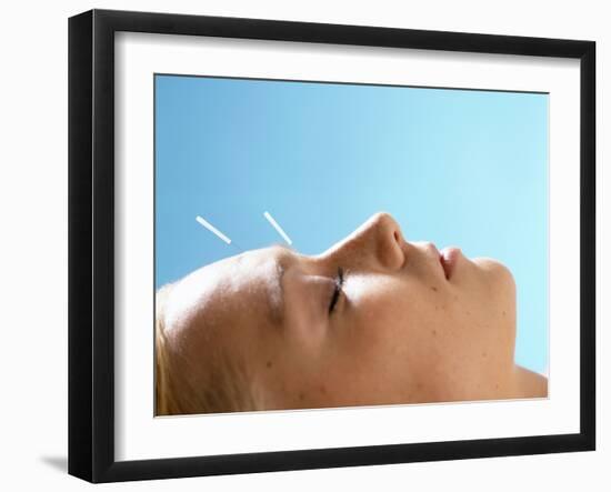 Acupuncture-Mauro Fermariello-Framed Photographic Print