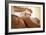 Acupuncture-Adam Gault-Framed Photographic Print