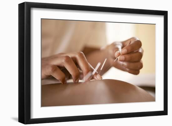 Acupuncture-Adam Gault-Framed Photographic Print