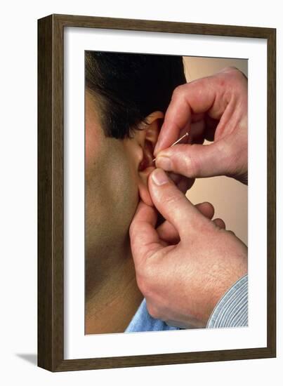 Acupuncturist's Hands Insert Needle Into Man's Ear-Damien Lovegrove-Framed Photographic Print