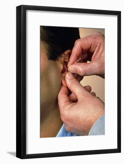 Acupuncturist's Hands Insert Needle Into Man's Ear-Damien Lovegrove-Framed Photographic Print