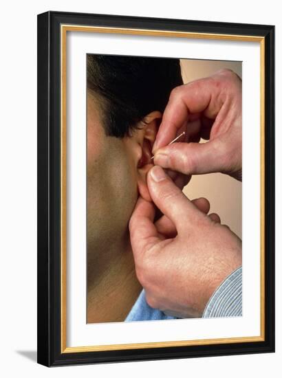 Acupuncturist's Hands Insert Needle Into Man's Ear-Damien Lovegrove-Framed Photographic Print