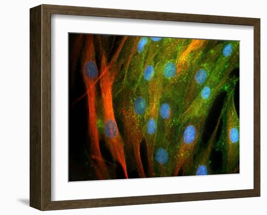 Adipose Stem Cells, Light Micrograph-Riccardo Cassiani-ingoni-Framed Photographic Print