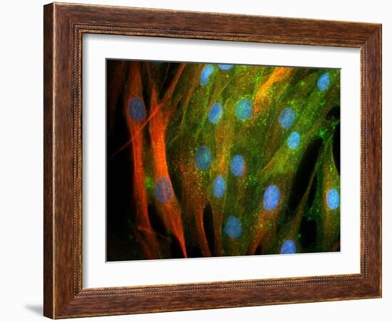 Adipose Stem Cells, Light Micrograph-Riccardo Cassiani-ingoni-Framed Photographic Print