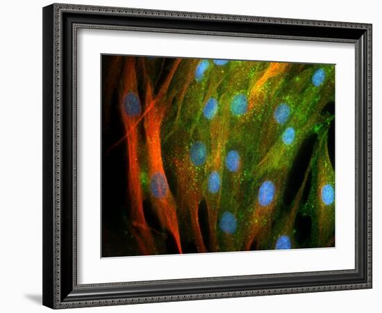 Adipose Stem Cells, Light Micrograph-Riccardo Cassiani-ingoni-Framed Photographic Print