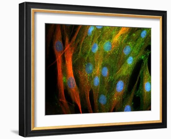 Adipose Stem Cells, Light Micrograph-Riccardo Cassiani-ingoni-Framed Photographic Print