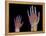 Adult And Child Hand X-rays-Science Photo Library-Framed Premier Image Canvas