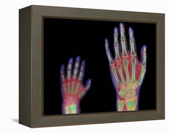 Adult And Child Hand X-rays-Science Photo Library-Framed Premier Image Canvas