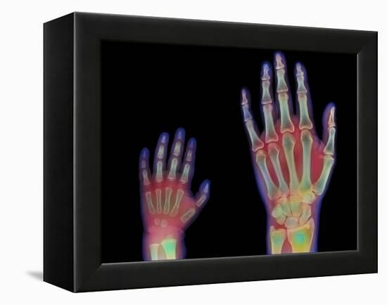 Adult And Child Hand X-rays-Science Photo Library-Framed Premier Image Canvas