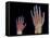 Adult And Child Hand X-rays-Science Photo Library-Framed Premier Image Canvas