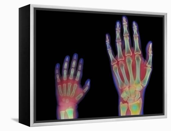 Adult And Child Hand X-rays-Science Photo Library-Framed Premier Image Canvas