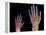 Adult And Child Hand X-rays-Science Photo Library-Framed Premier Image Canvas