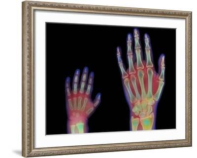 Human skeleton, hand and wrist bones, close up available as Framed Prints,  Photos, Wall Art and Photo Gifts