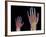 Adult And Child Hand X-rays-Science Photo Library-Framed Photographic Print