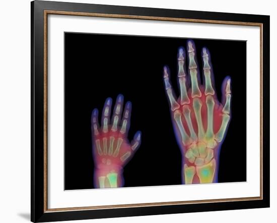 Adult And Child Hand X-rays-Science Photo Library-Framed Photographic Print