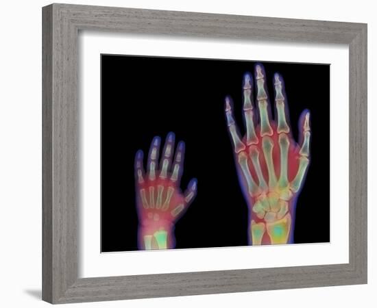 Adult And Child Hand X-rays-Science Photo Library-Framed Photographic Print