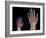 Adult And Child Hand X-rays-Science Photo Library-Framed Photographic Print