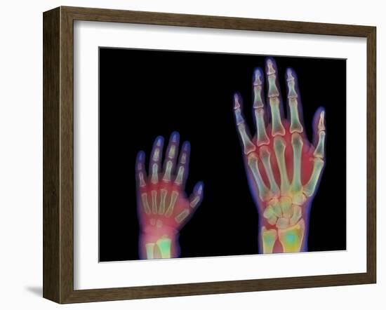 Adult And Child Hand X-rays-Science Photo Library-Framed Photographic Print