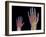 Adult And Child Hand X-rays-Science Photo Library-Framed Photographic Print