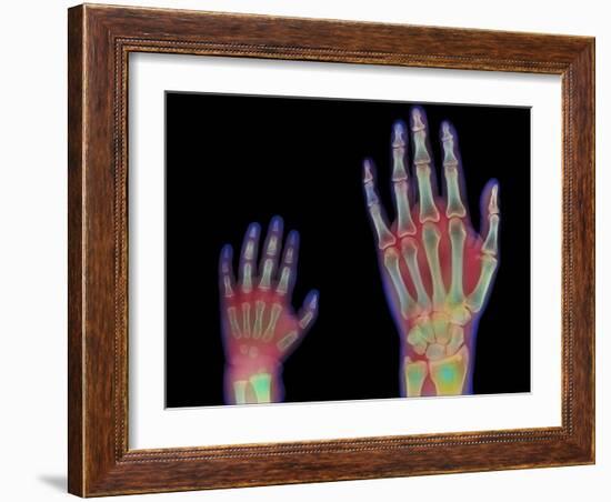 Adult And Child Hand X-rays-Science Photo Library-Framed Photographic Print