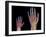 Adult And Child Hand X-rays-Science Photo Library-Framed Photographic Print