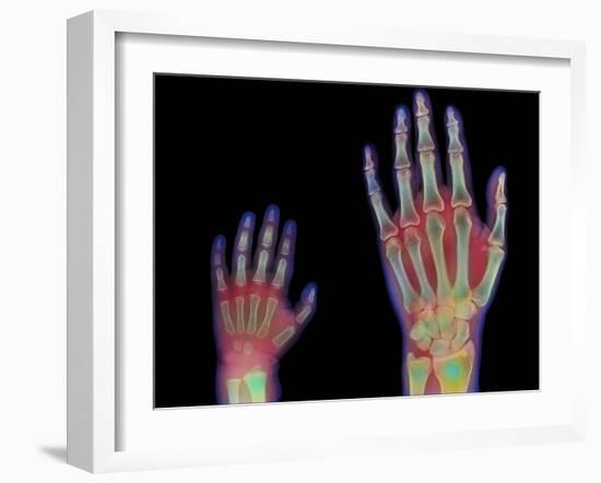 Adult And Child Hand X-rays-Science Photo Library-Framed Photographic Print